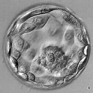 5 day blastocyst